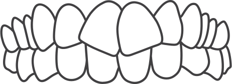 Dentes apinhados