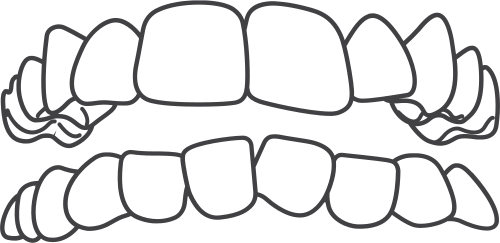 Alinhamento geral dos dentes